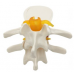 Demonstrate of Disc of Bone